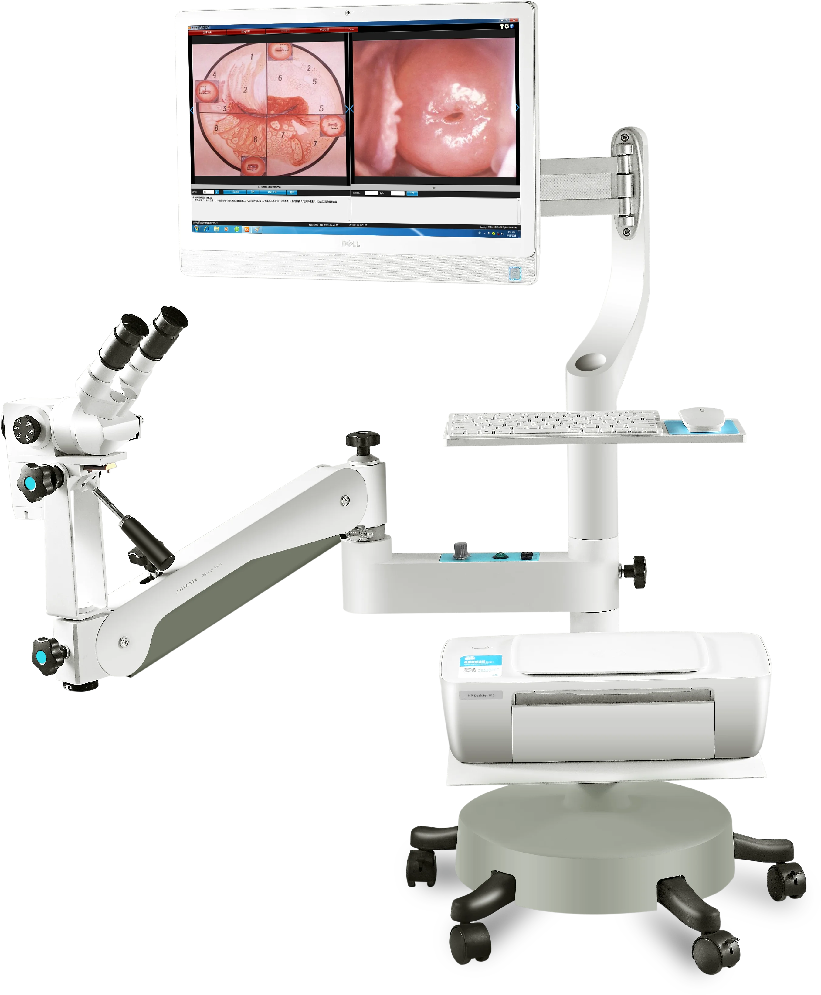 2024 Hot selling ISO Approved Optical Colposcope for Women Examination Vagina Colposcopy System for Gynecology Test
