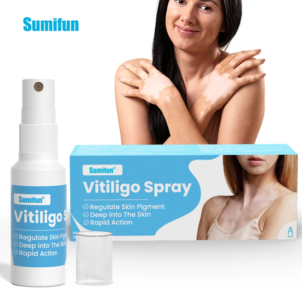 Sumifun Wholesale 30ml Vitiligo Treatment Remover Spray White Spot Skin Care Spray