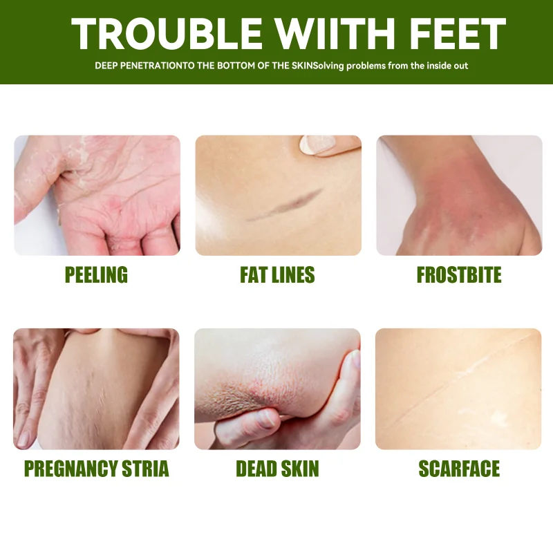 Anti Crack Foot Cream Heel Cracked Repair Horse Oil Cream Smooth Removal Dead Skin Callus Anti-Drying Hand Feet Skin Care 30g