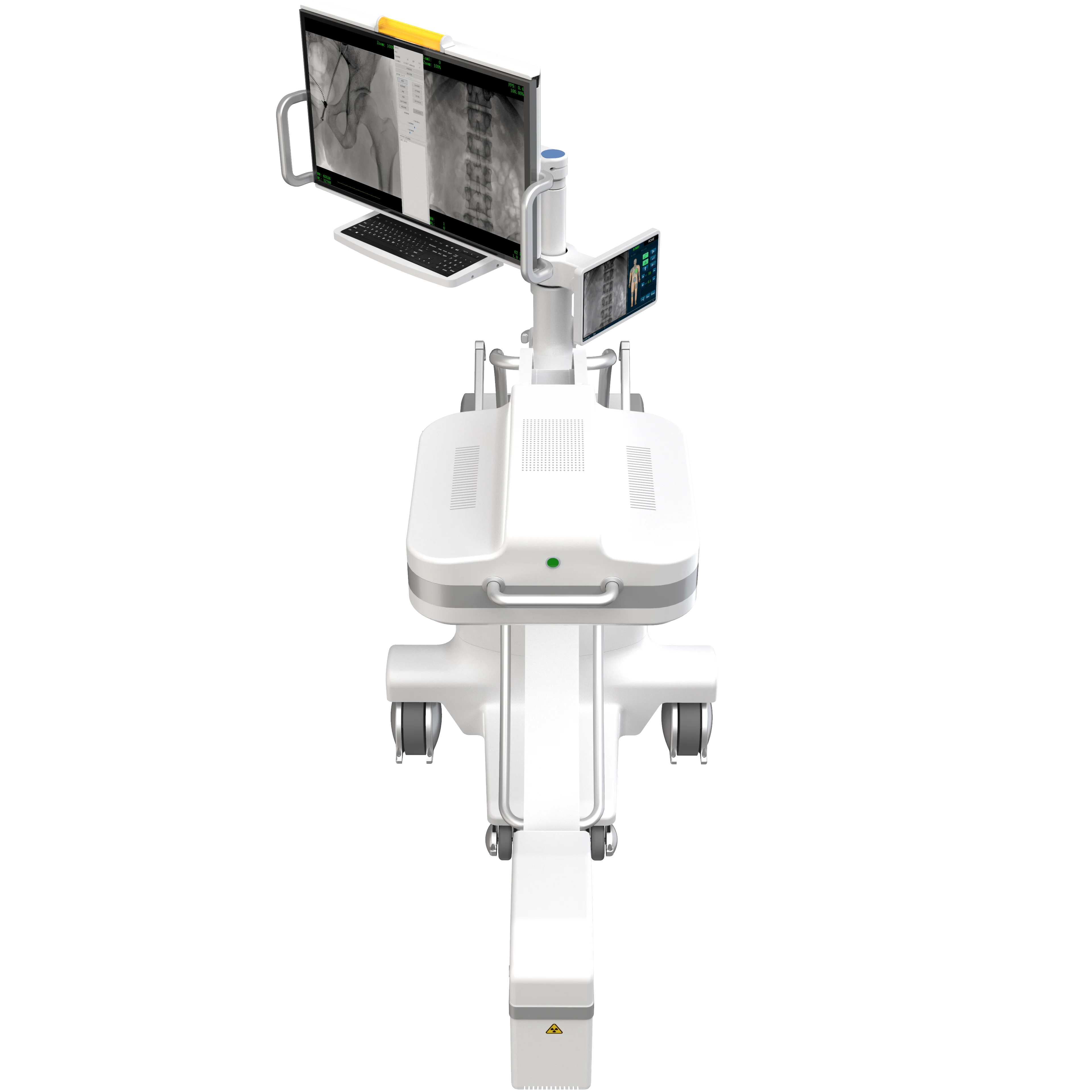 PLX119C Mobile C-arm System with Upgraded FPD
