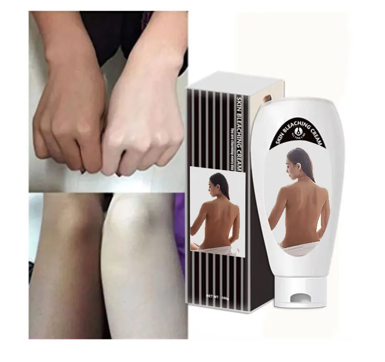 Лосьон с апельсиновым пилингом для красоты тела, отбеливающий крем для темного Дерма, отбеливающий глютатионный отбеливающий крем для кожи