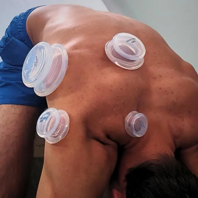 Large Size Silicone Transparent Cupping Set Suction Cups for Massage Therapy