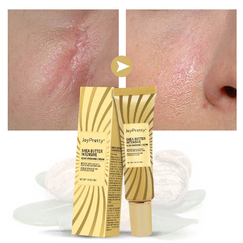 Herbal Acne Spots Treatment Burn Surgical Scars Smooth Whitening Face Body Skin Care Acne Scar Removal Cream