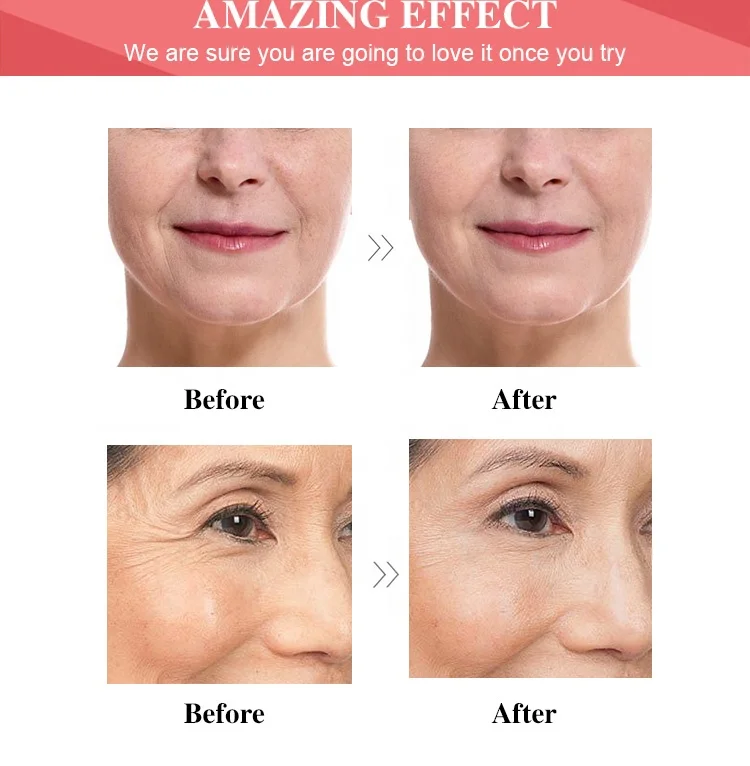 Korean 30ml Hyaluronic Acid Serum Whitening Anti-Aging Liquid Blue Peptide Skin Care Face Serum