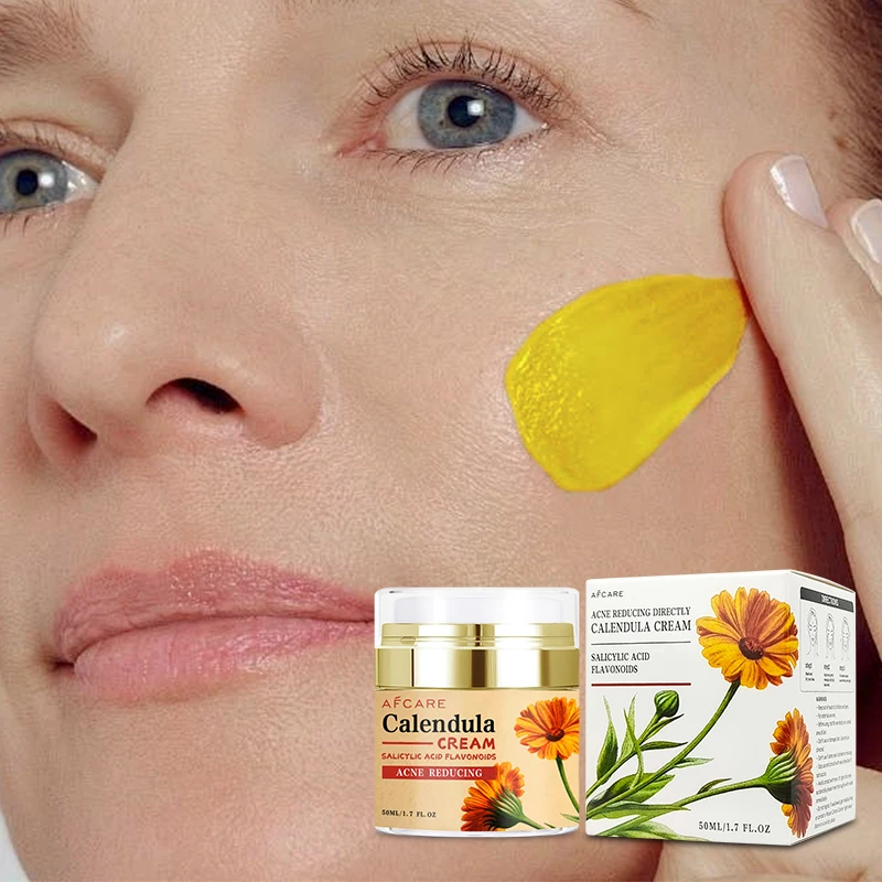 Chinese Brand Face Cream Paraben-free Repair Nourishing & Hyaluronic acid & Calendula Face Cream for Whitening and Acne