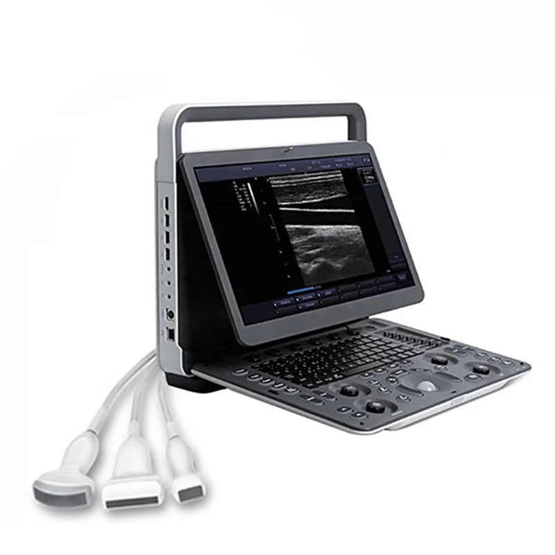 Factory low price Ce Approved Portable Ultrasound Doppler Scanner