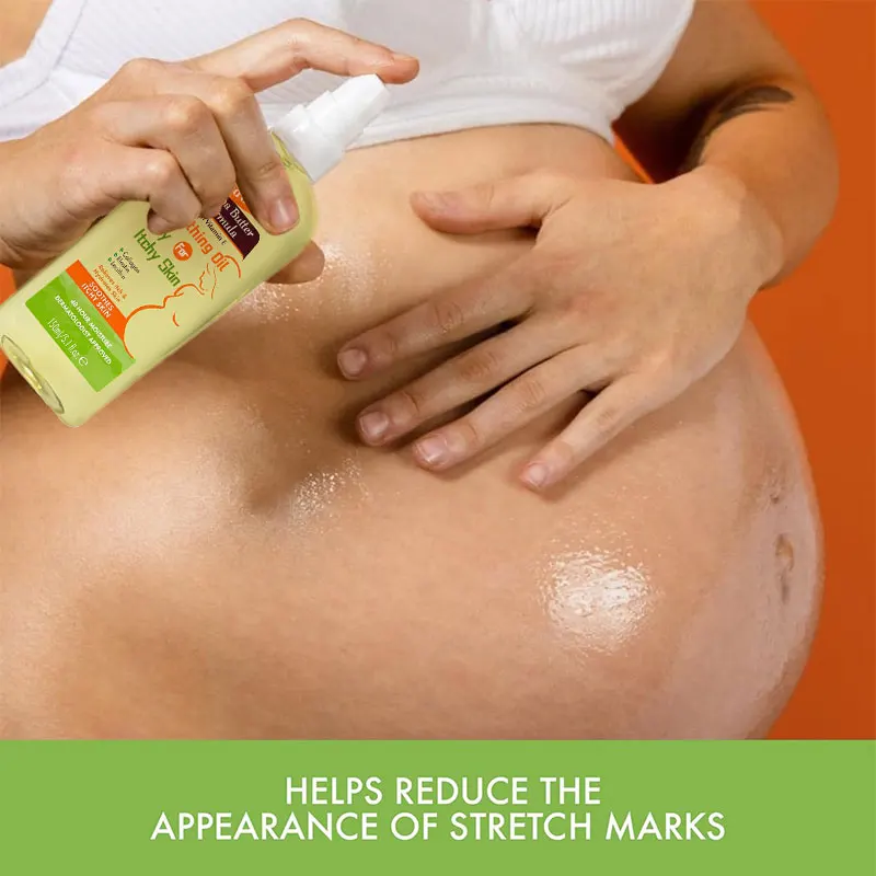 Cocoa Butter Formula Soothing Oil With Vitamin E Dry Itchy Skin Relief Pregnancy-Safe Anti-Itch Body Oil 5.1 Ounces