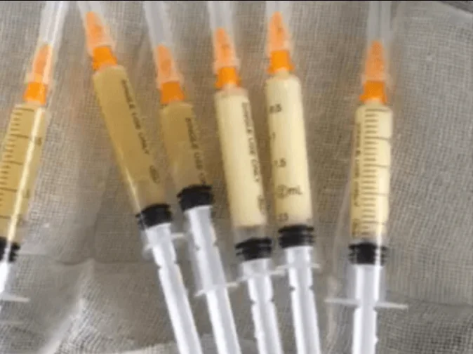 Аппарат для приготовления геля PRP/PRF Gel preparer готовит аутологичные наполнители