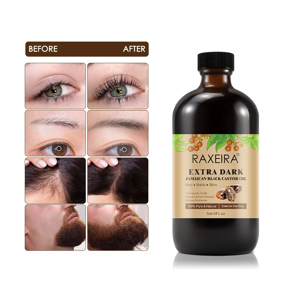 Fast Strengthening Rosemary Oil Organic Hair Growth Black Castor Oil Rosemary Mint Private Label Best Hair Growth Products