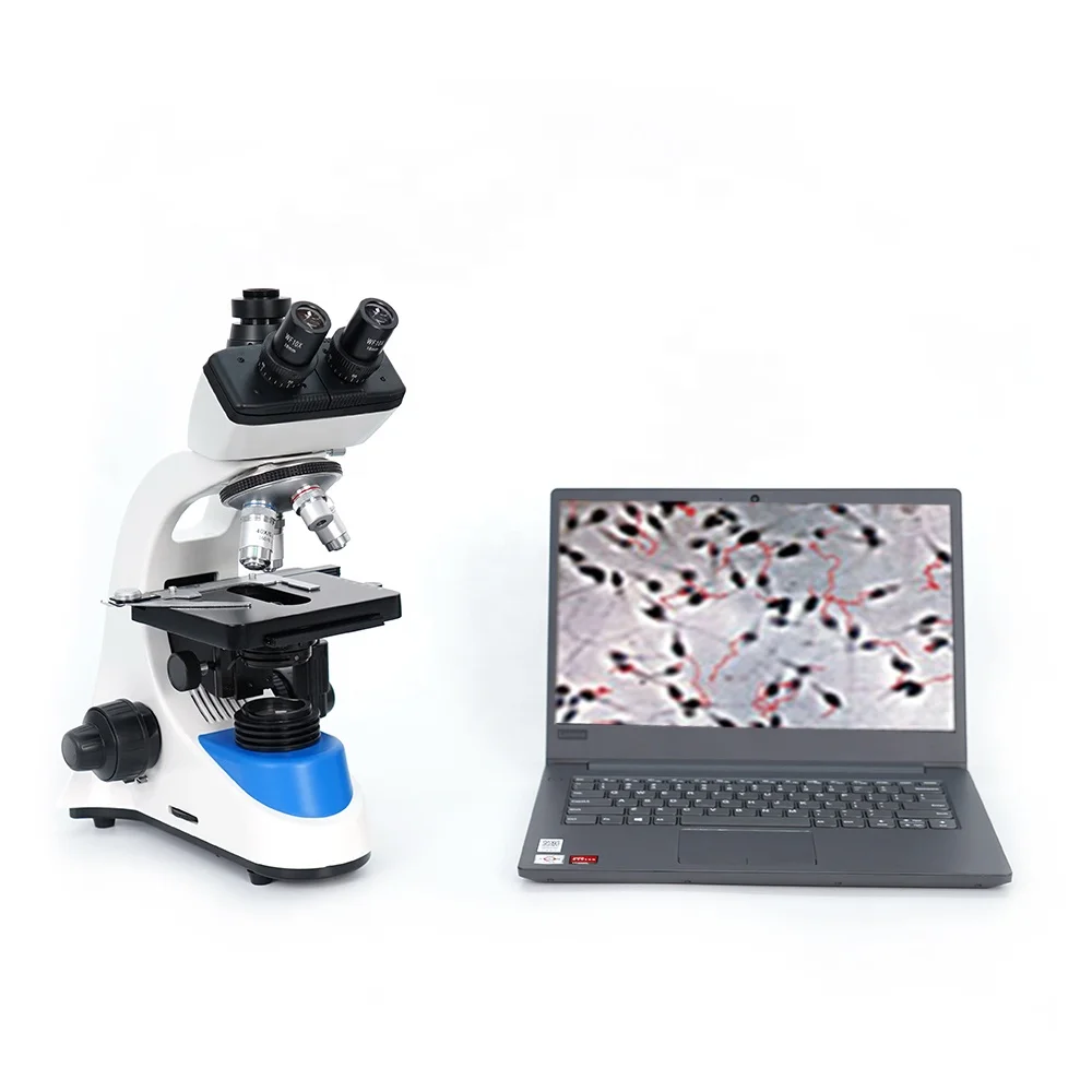 Vet Animal Cow Sperm Analyzer Count Microscope Portable Automated Dog Cattle Veterinary Semen Analyzer