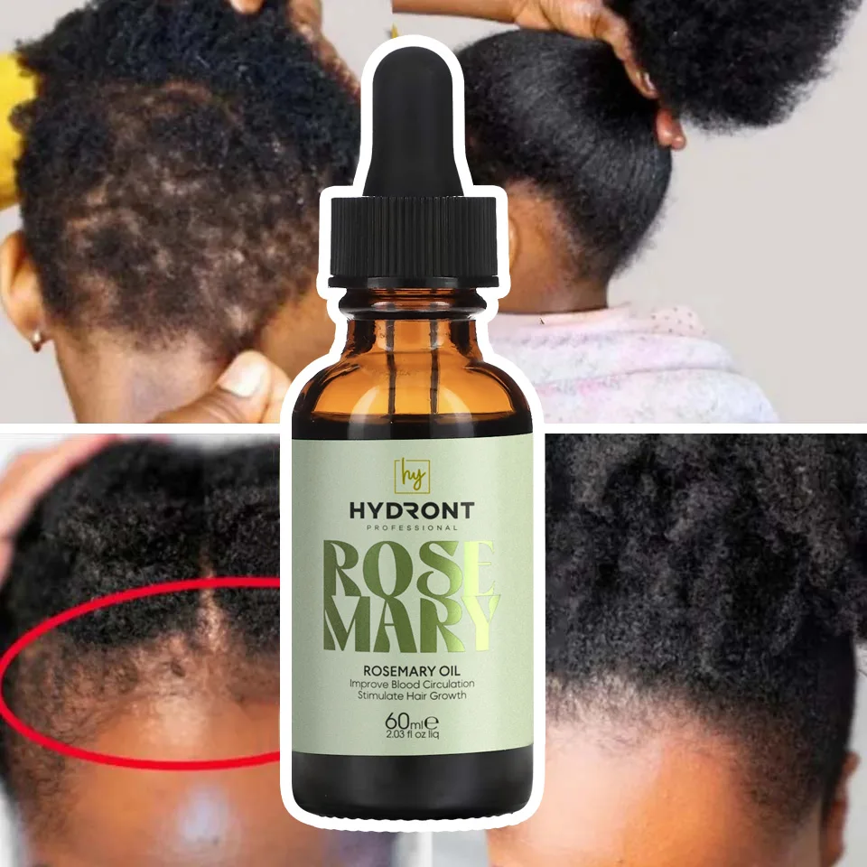 private label kooswalla best seller natural and pure rosemary oil hair growth carrier oil