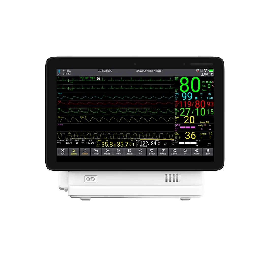 CONTEC TS15 newtech multipara  patient monitor medical grade