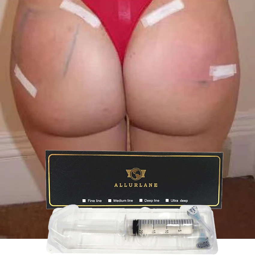 
breast and buttock injections injectable hyaluronic fillers for body use  (1600200611200)
