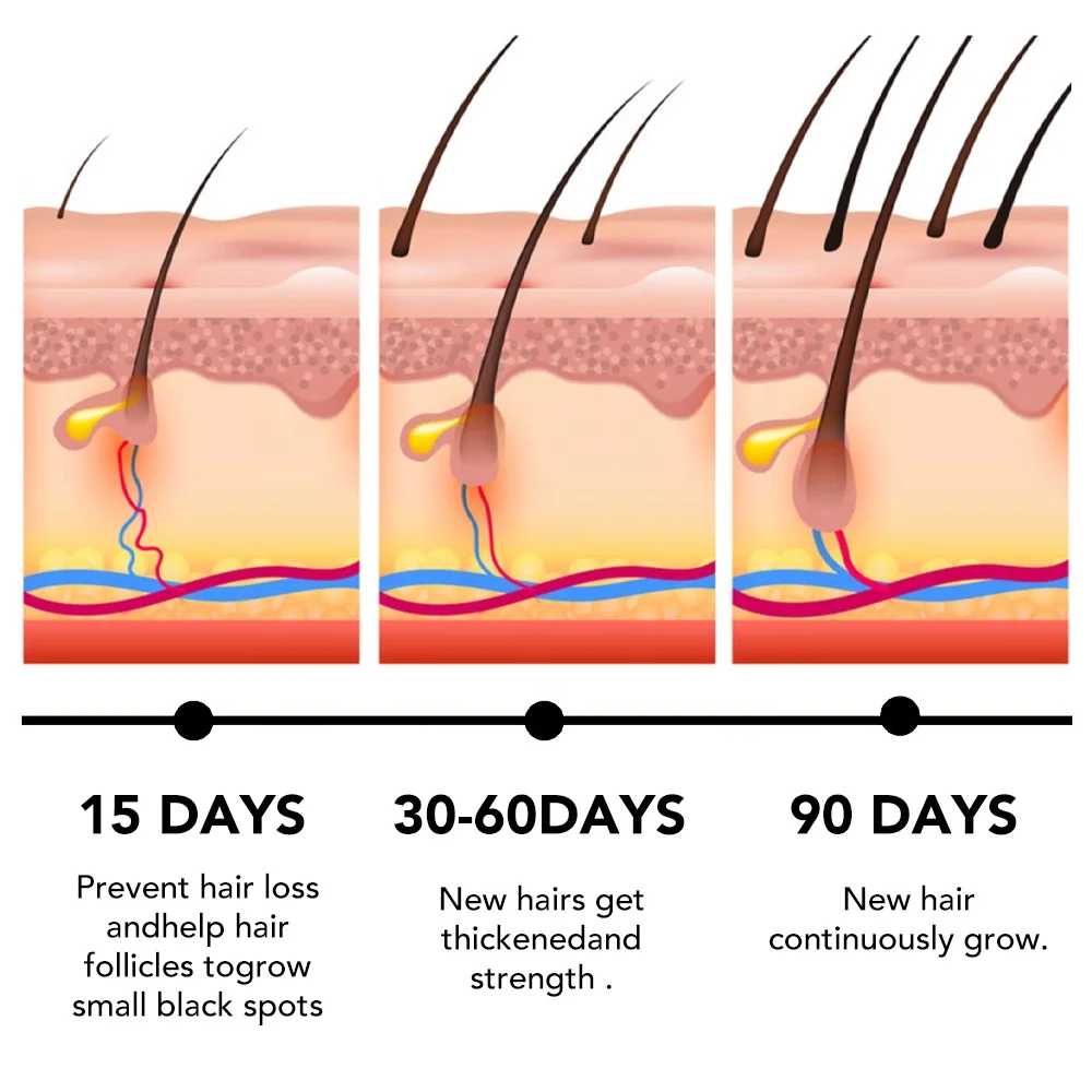 Growth For Hair Rosemary Oil Serum Repairs Luxury Hair Growth Rosemary Mint Hair Serum Oil