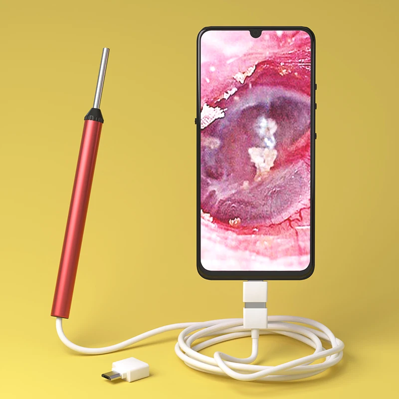 Usb-отоскоп 3 9 мм