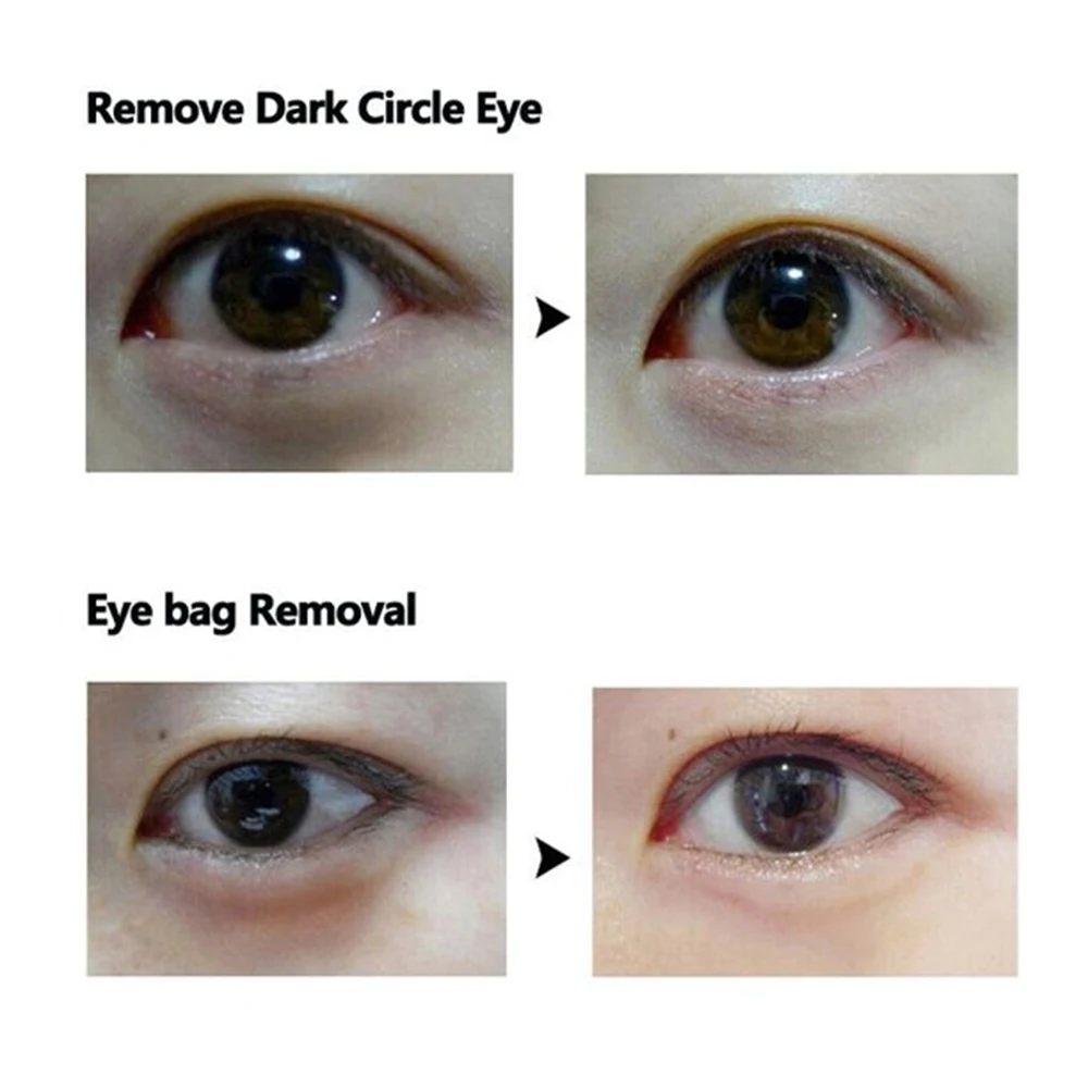 OEM ODM Supply Anti Wrinkle Dark Circles Puffiness Eye Serum For Cosmetic