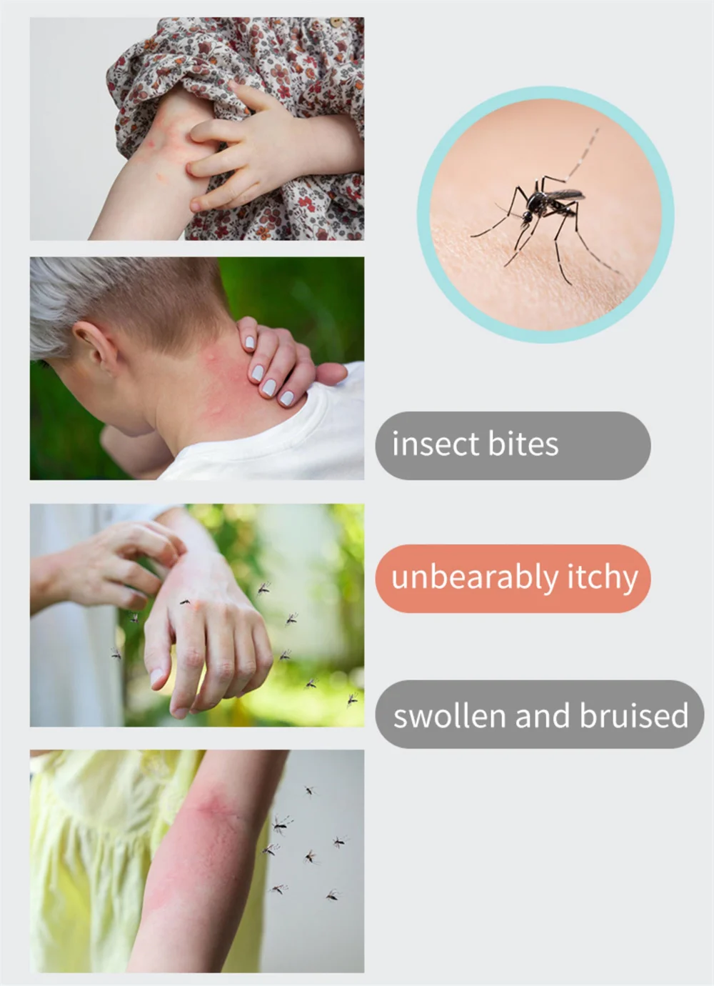 CE MDR Class IIa Insect Bite Healer Mosquito Bite Heat Pen Quick Insect Bite Relief of Itching and Swelling