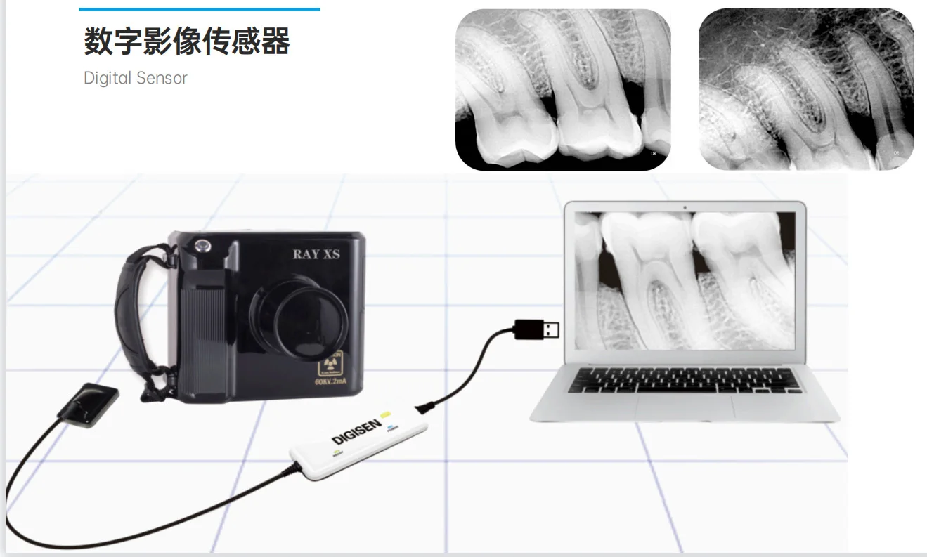 2021 Low Price  digital x ray sensor  X-Ray Sensor Dental Digital Sterilizable X Ray Sensor with good quality
