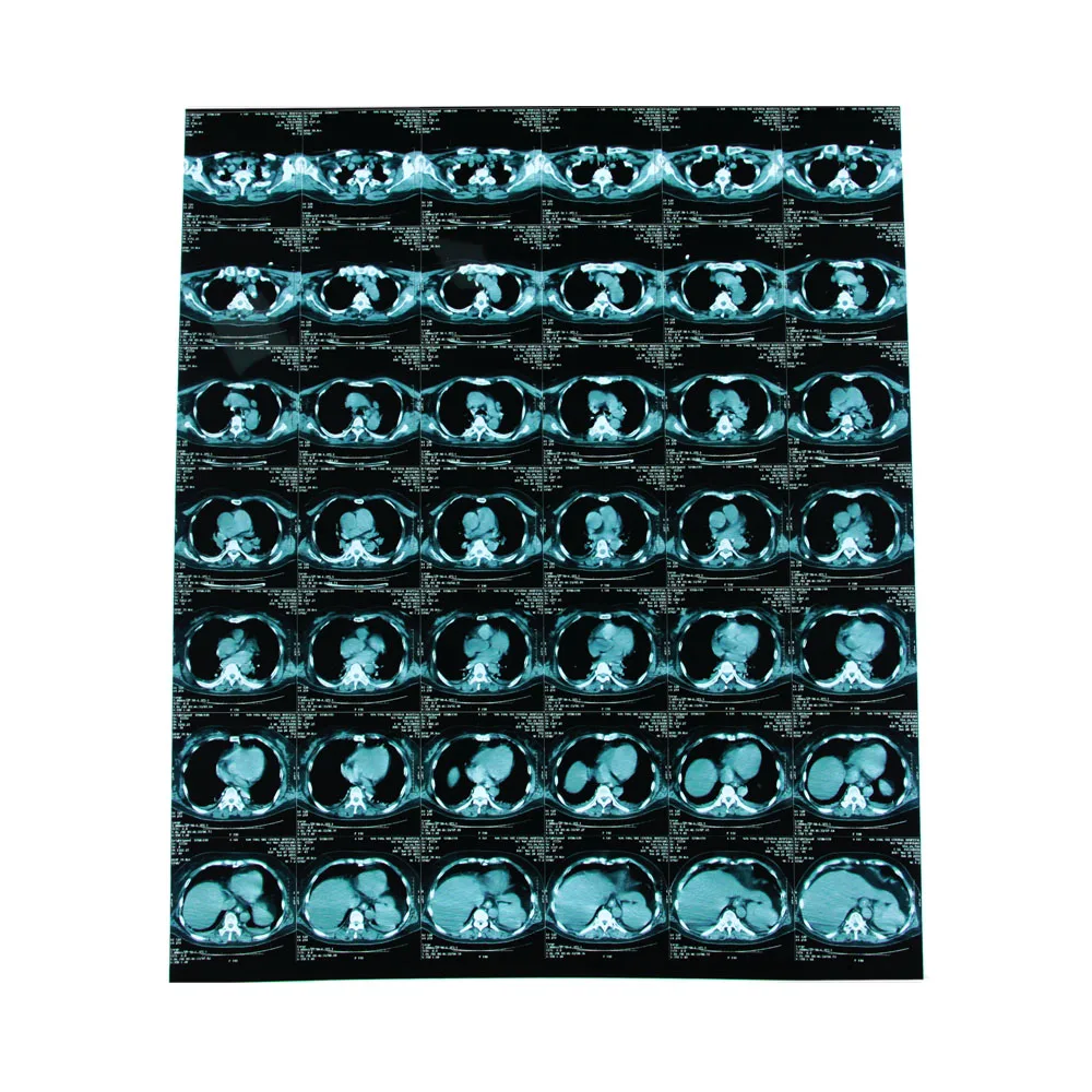 
Cheap price medical thermal film dry imaging laser x-ray film for AGFA FUJI x ray film 