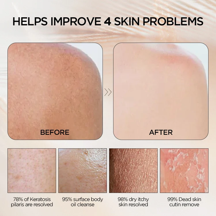 Shopee Hot Sell Deep Viscose Exfoliating Gloves For Shower And Spa Massage Great For Applying Fake Tan