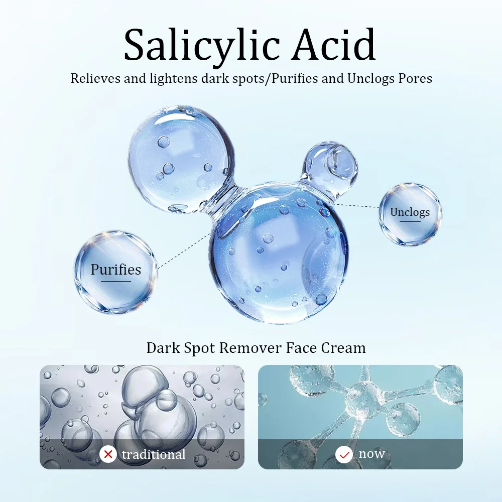 Private Label Dark Spot Freckle Corrector Remover Face Whitening Creams Lotion to Remove Dark Spots
