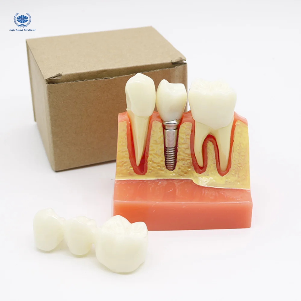 Dental model for medical teaching Dental plastic tooth model