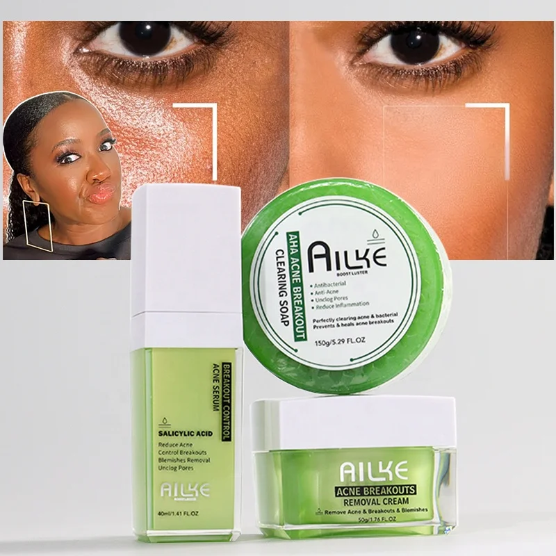 Оптовая продажа 3 шага Молодежные средства для лечения прыщей светящаяся Чистка жирной кожи лица набор ухода за прыщами подростков