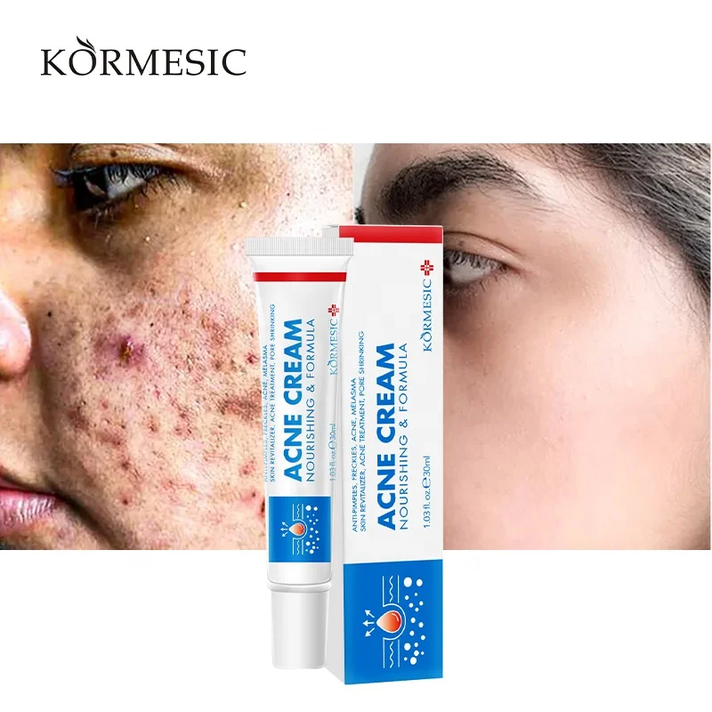 OEM ODM частная торговая марка KORMESIC против акне удаление темных пятен растягивание шрамов от отбеливающий крем для лица