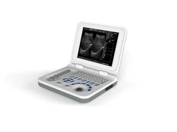 Portable Black and White Ultrasound Best Price China Medical Ultrasound Scanner portable ultrasound price