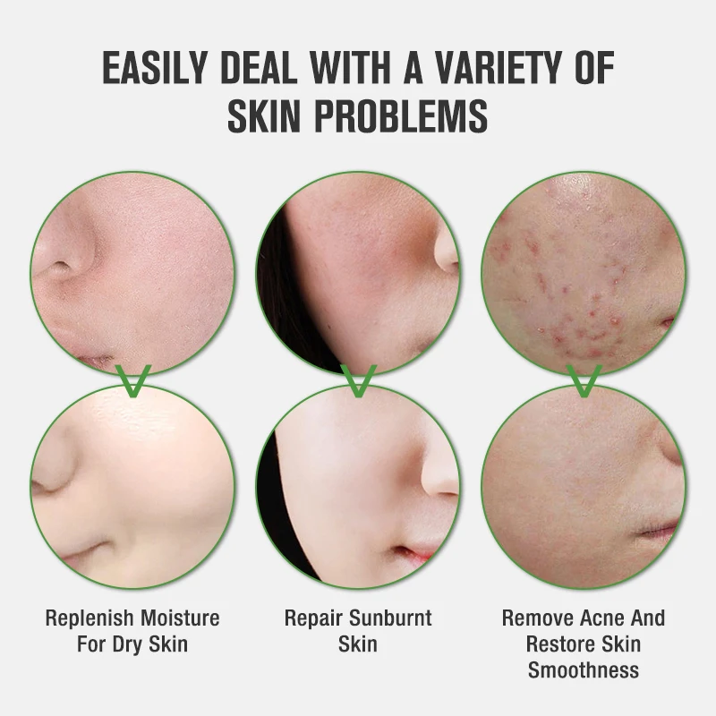 Organic Aloe Vera Gel With 100% Pure Aloe Paraben-Free Moisturizer Soothing and Natural Aloe Vera Gel Private Label