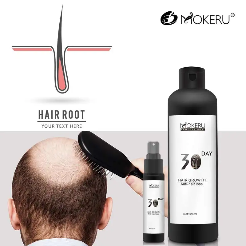 
Professional hair growth treatment natural herbal ingredient 30 days hair regrowth lotion anti hair loss product 