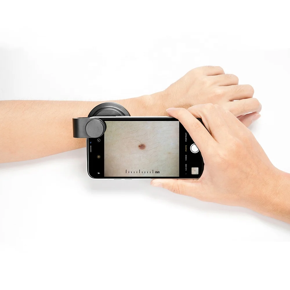 IBOOLO small smart gadget de400 dermatoscopy for dermatology