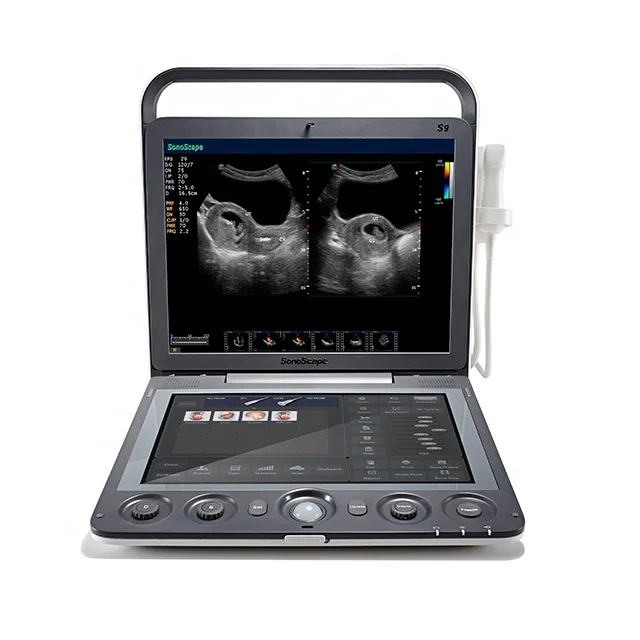 medical ultrasound instruments SonoScape S9 4D portable color doppler ultrasound machine price