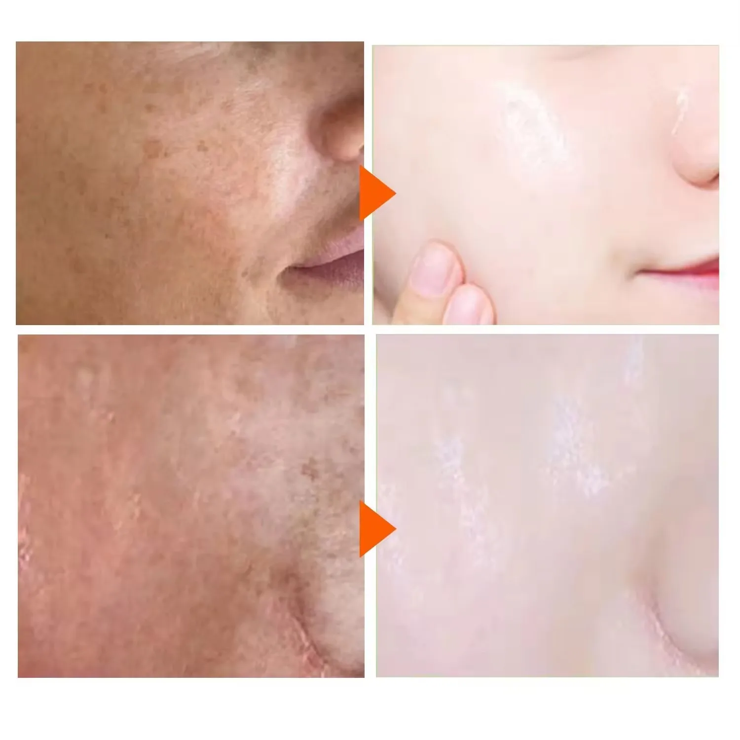Customized Support Gluta White Cream Skin And Face Lightening Bleach Whitening Cream For Wholesale