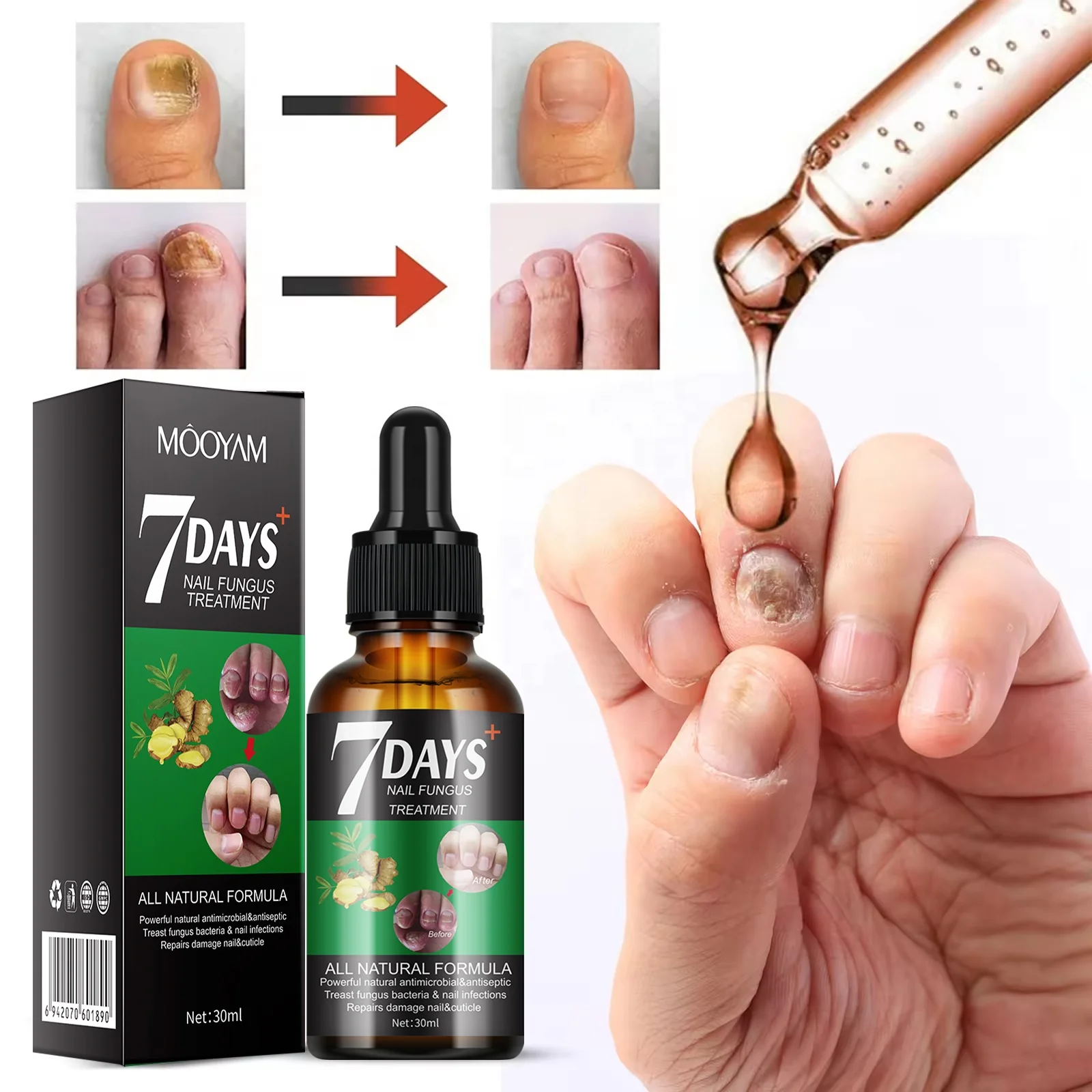 Private Label 7DAYS Nail Fungus Treatment Serum Hand Foot Care Removal Gel Anti-infective Repair Nail Serum
