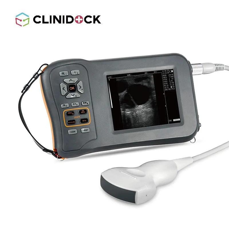 Digital Veterinary Ultrasound Diagnostic System