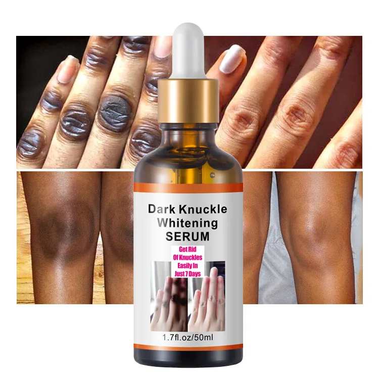 Support small batch custom OEM Quick Whitening Serum Pigmentation Corrector Hand Joint Elbow Knee whitening serum for skin