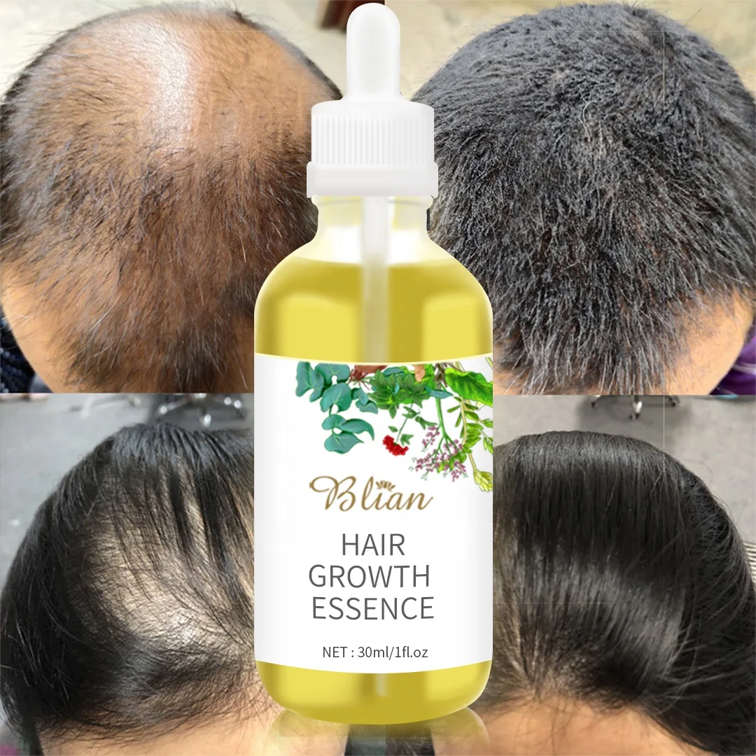 Hair Growth Oil Nine Effective Oils To Regrow Longer Thicker Hair - For Men And Women Coconut Hair Growth Oil
