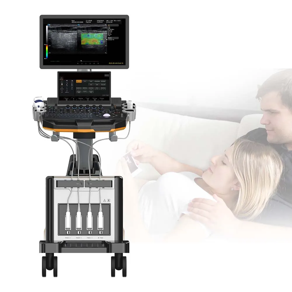 Main screen 21.5 inch medical HD display Color Doppler  Economical Type Trolley Ultrasound Machine