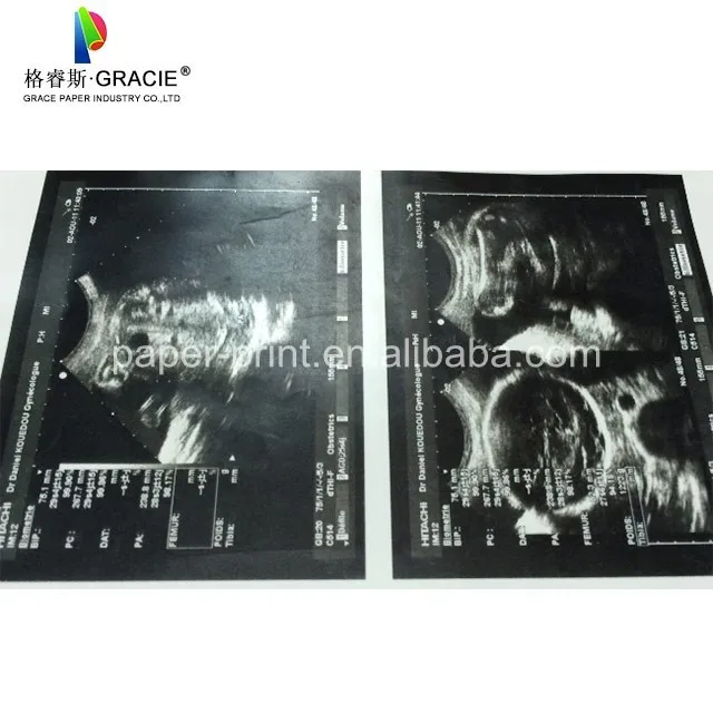 110mm*20m 110S Ultrasound Thermal Paper For Medical Printer