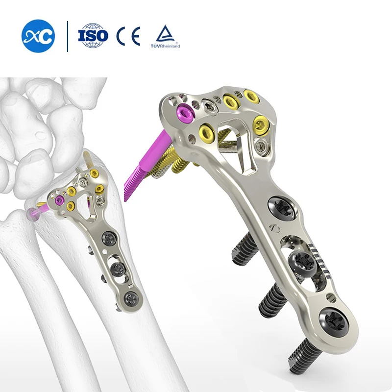Universal Curved Ortho Implant Orthopedic Locking Plate, Ortopedia Placa Radio Distal Trauma Titanium Plates Orthopedic Implant