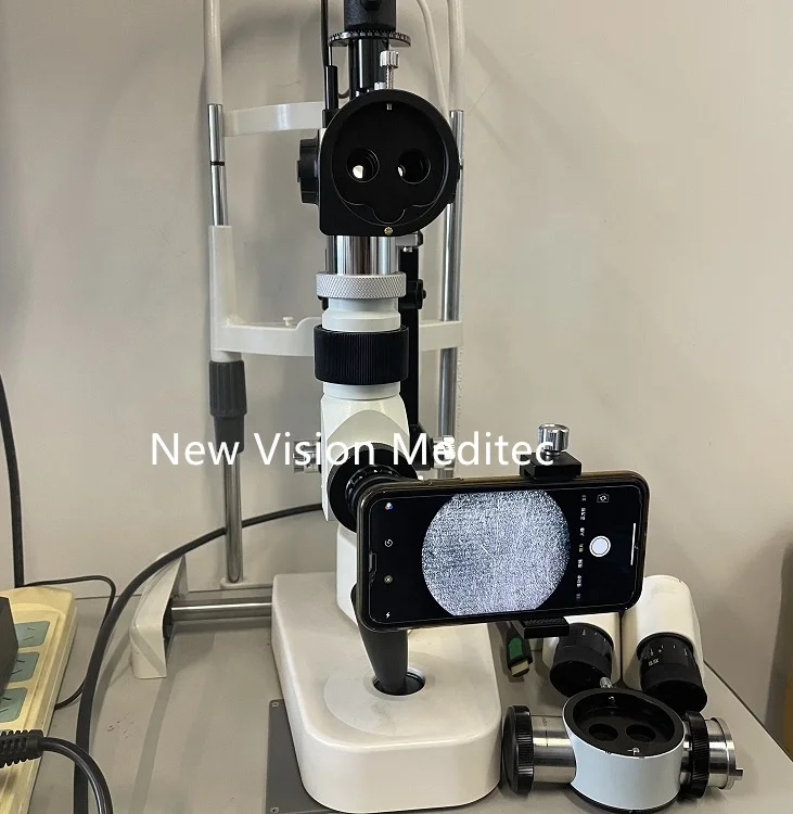 8K Smartphone Video Adapter for Surgical Microscopes and Slit Lamps