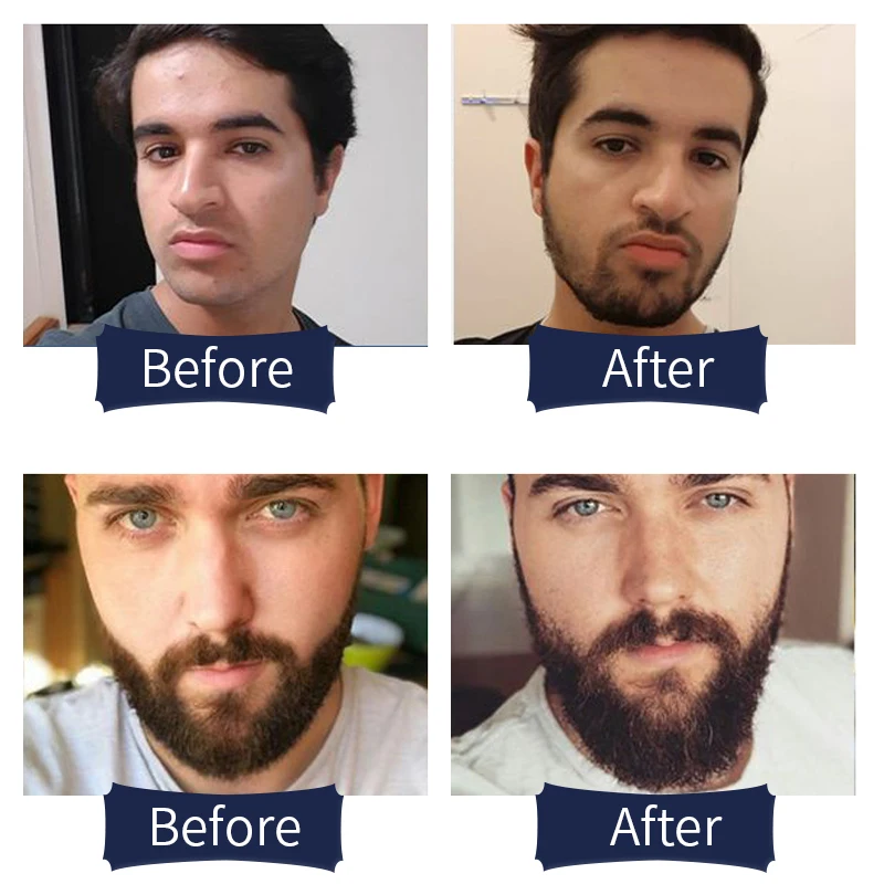 Собственная Марка 50 MOQ индивидуальный лучший уход за бородой мужское органическое масло жожоба Beardoil в комплекте способствует росту бороды масло