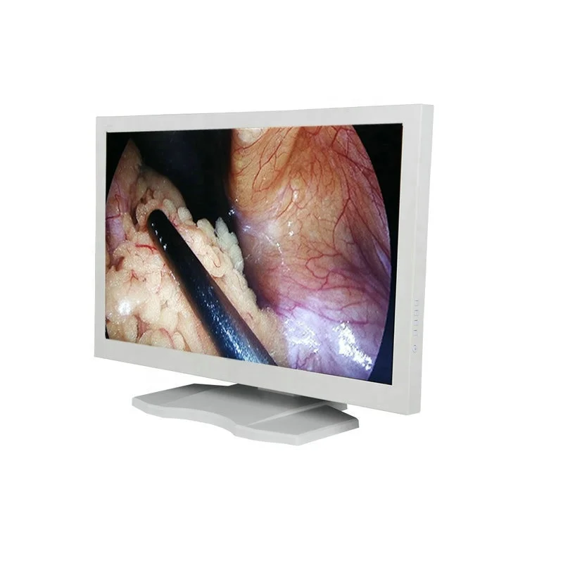 The new endoscopic camera system surgery is a complete set of laparoscopic towers with instruments