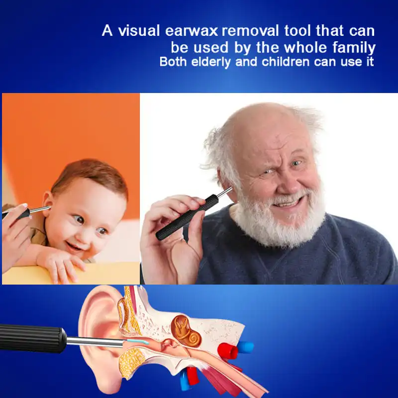 A-smart Visual Ear Cleaning Stick 1000w Hd Pixel Ear Endoscope Ear Wax Removal Tool For Adults And Children