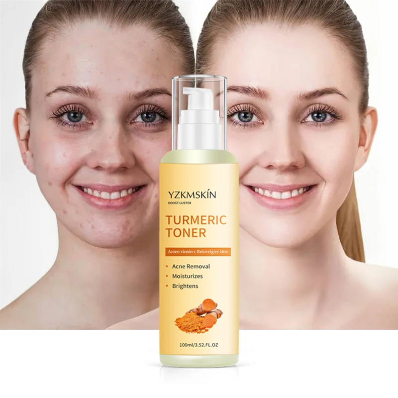 private label korean face toner bulk brightening ordinary lightening  brightening  skin toner white  clenser moisterizer