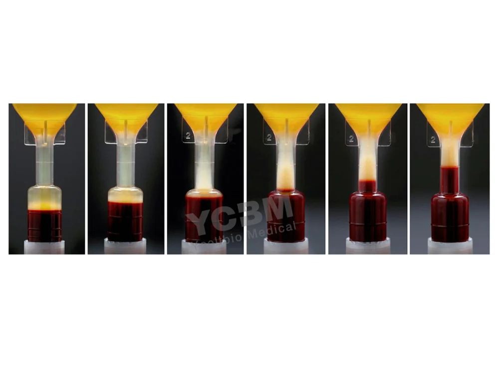 Оригинальный корейский высококачественный YCELLBIO Good PRP tube kit CE сертифицированный ортопедический