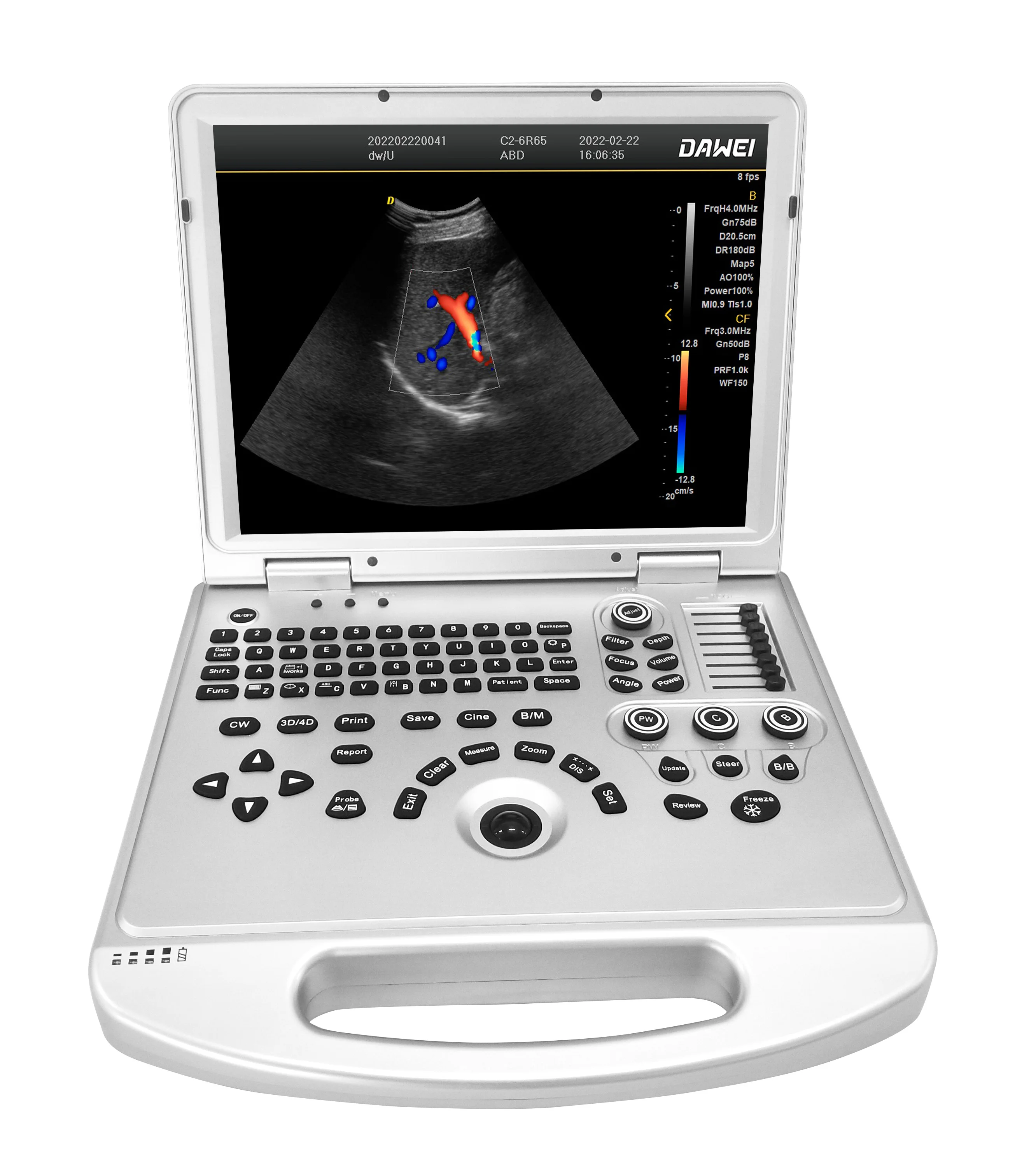 Buy Dawei ultrasound equipment DW-L3 laptop color Doppler  ultrasound scanner