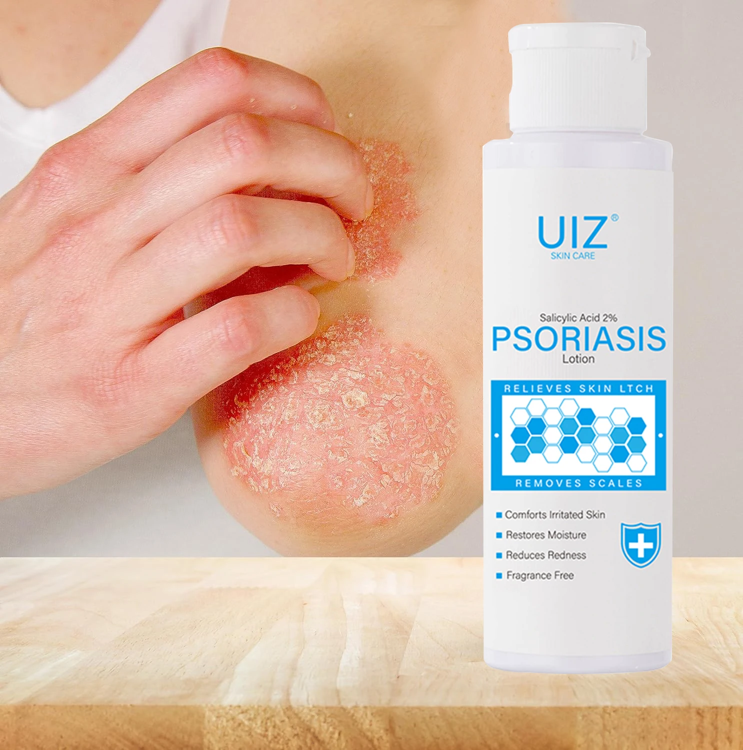 Hot Selling 100G Soothe Psoriasis Eczema Care Body Lotion Improve Dry Itchy Sensitive Skin Repair moisturizing