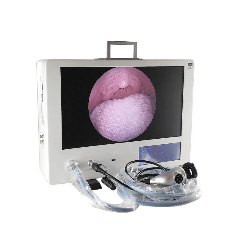 telepack all in one Portable Medical Endoscopic camera system  full HD rigid Endoscope Camera  with recording